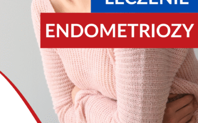 Leczenie endometriozy